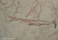 Attēlu rezultāti vaicājumam “Calocera glossoides”