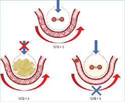 Image result for  v    q