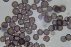 Attēlu rezultāti vaicājumam “Didymium xanthopus spores”