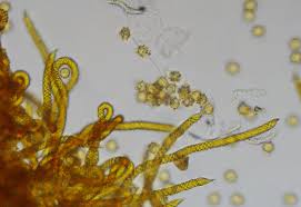 Attēlu rezultāti vaicājumam “Oligonema persimile macro”