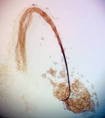 Attēlu rezultāti vaicājumam “Paradiacheopsis rigida stalked”