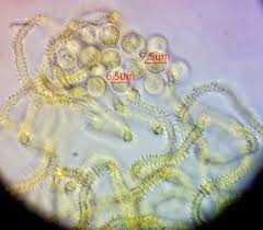 Attēlu rezultāti vaicājumam “Heterotrichia oerstedii (syn. Arcyria oerstedii) sessile”