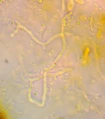 Attēlu rezultāti vaicājumam “Willkommlangea reticulata macro”