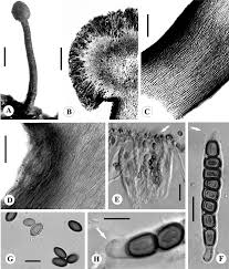 Attēlu rezultāti vaicājumam “Chaenotheca chlorella”