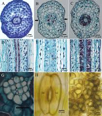 Attēlu rezultāti vaicājumam “Stemonitopsis aequalis var. microspora spores”