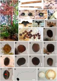 Attēlu rezultāti vaicājumam “Rosellinia desmazieri spores”