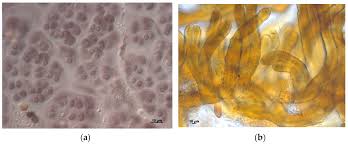 Attēlu rezultāti vaicājumam “Gloeocapsa rupestris”