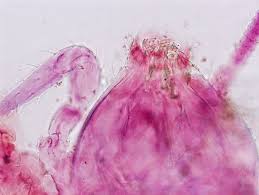 Attēlu rezultāti vaicājumam “Symphypleona”