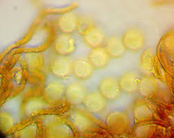 Attēlu rezultāti vaicājumam “Hemitrichia chrysospora”