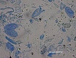 Attēlu rezultāti vaicājumam “Verrucaria hydrela”
