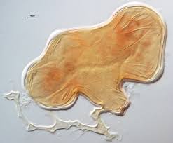 Attēlu rezultāti vaicājumam “Stemonaria irregularis spores”