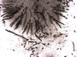 Attēlu rezultāti vaicājumam “Melanospora lagenaria”