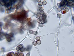 Attēlu rezultāti vaicājumam “Diderma hemisphaericum spores”