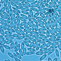 Attēlu rezultāti vaicājumam “Licea castanea spores”