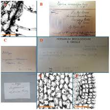 Attēlu rezultāti vaicājumam “Jungermannia hyalina cells”