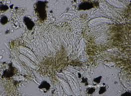 Attēlu rezultāti vaicājumam “Alyxoria varia”