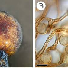 Attēlu rezultāti vaicājumam “Enerthenema papillatum spores”