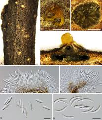 Attēlu rezultāti vaicājumam “Diachea dictyospora (syn. Craterium dictyosporum) spores”