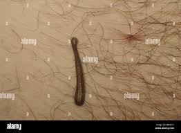 Attēlu rezultāti vaicājumam “Hirudinea”