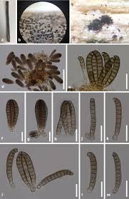 Attēlu rezultāti vaicājumam “Rosellinia desmazieri spores”