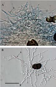 Attēlu rezultāti vaicājumam “Anaptychia ciliaris”
