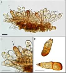 Attēlu rezultāti vaicājumam “Puccinia agrostidis”