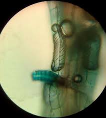 Attēlu rezultāti vaicājumam “Sphagnum magellanicum”