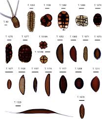 Attēlu rezultāti vaicājumam “Rosellinia desmazieri spores”