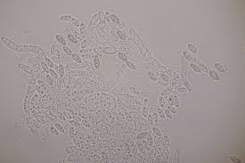 Attēlu rezultāti vaicājumam “Nectria episphaeria”