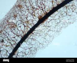 Attēlu rezultāti vaicājumam “Stemonitopsis hyperopta”