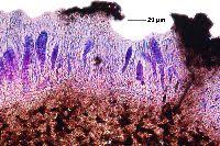 Attēlu rezultāti vaicājumam “Plectocarpon lichenum”