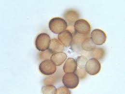 Attēlu rezultāti vaicājumam “Tranzschelia pruni-spinosae spores”