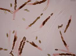 Attēlu rezultāti vaicājumam “Anthostoma decipiens”