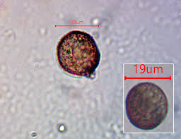 Attēlu rezultāti vaicājumam “Licea pusilla”