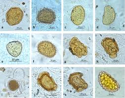 Attēlu rezultāti vaicājumam “Trichia alpina spores”