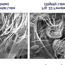 Attēlu rezultāti vaicājumam “Lamproderma gulielmae”