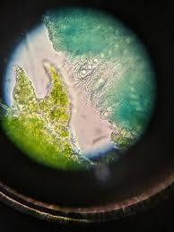 Attēlu rezultāti vaicājumam “Octosporella jungermanniarum”