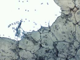 Attēlu rezultāti vaicājumam “Ophiotheca chrysosperma spores”