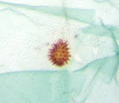 Attēlu rezultāti vaicājumam “Catoptria falsella”