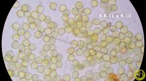 Attēlu rezultāti vaicājumam “Perichaena depressa spores”