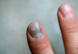 Image result for lunula nail