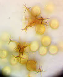 Attēlu rezultāti vaicājumam “Hemitrichia sordivesiculosa sessile”