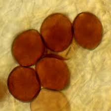 Attēlu rezultāti vaicājumam “Melanospora lagenaria”