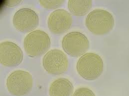 Attēlu rezultāti vaicājumam “Trichia alpina”