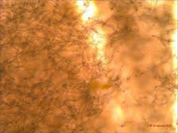 Attēlu rezultāti vaicājumam “Sarcoscypha austriaca var. lutea”