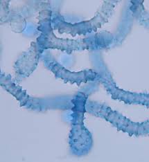 Attēlu rezultāti vaicājumam “Arcyria incarnata calyculus”