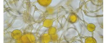 Attēlu rezultāti vaicājumam “Hemitrichia sordivesiculosa spores”