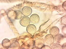 Attēlu rezultāti vaicājumam “Hemitrichia sordivesiculosa macro”