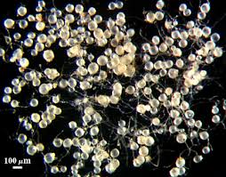 Attēlu rezultāti vaicājumam “Stemonitopsis aequalis var. microspora spores”