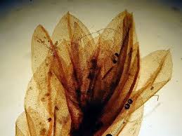 Attēlu rezultāti vaicājumam “Bryum neodamense”